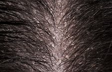 Les moyens pour le volume des cheveu près des racines sur les cheveux secs