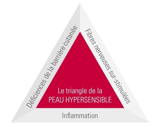 Triangle de la Peau Hypersensible