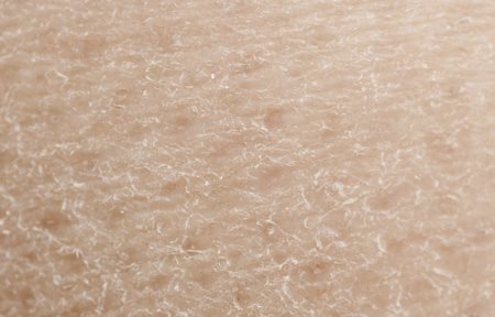 Gros plan sur une peau sèche